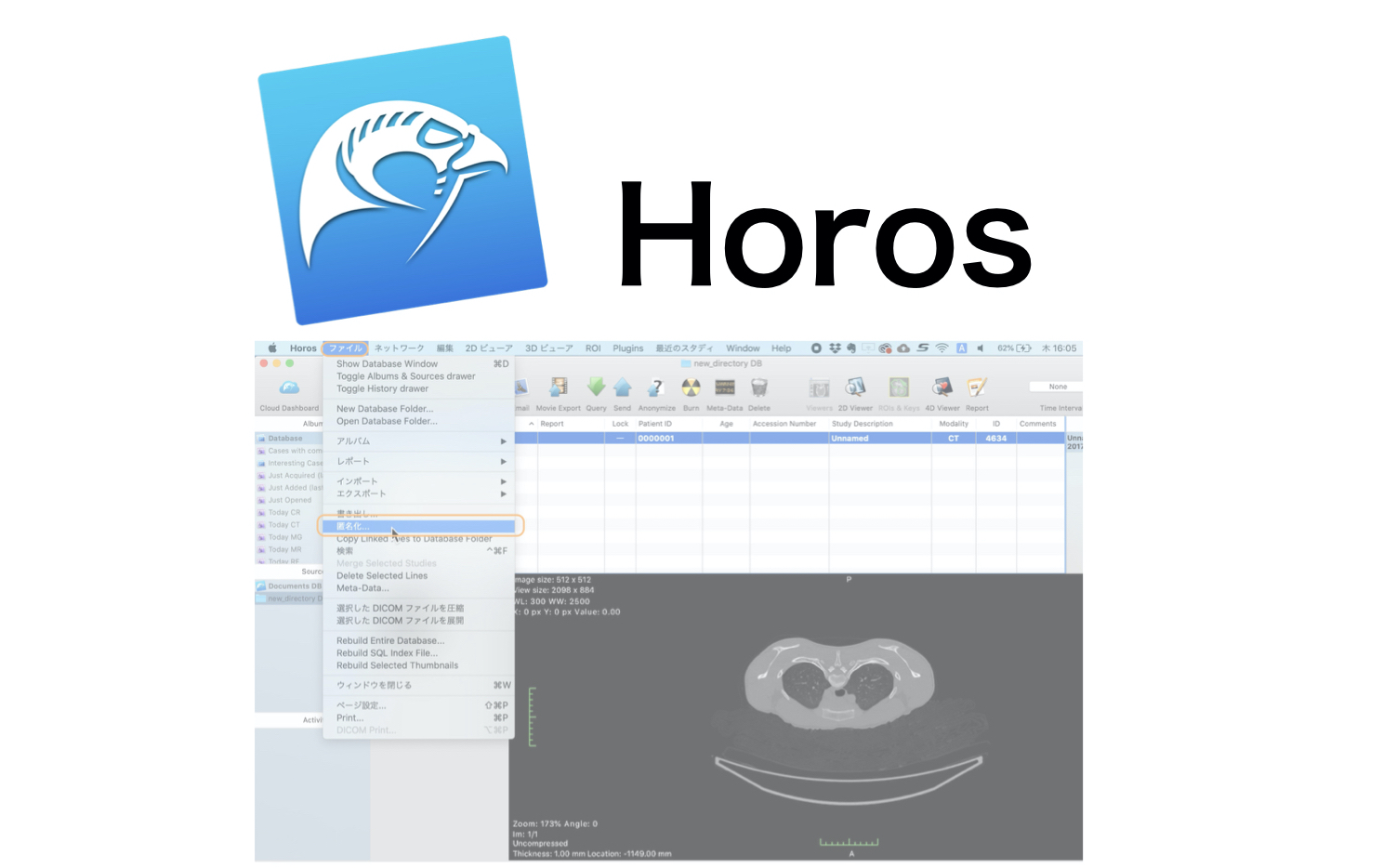 horos software
